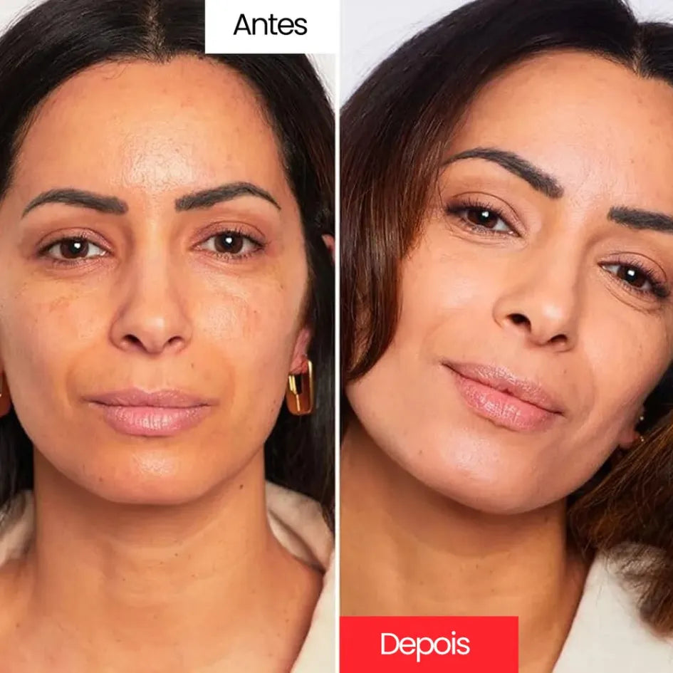 Centella Cream™ – Creme Corretivo Anti-Idade com Efeito Natural – Leve Mais e Pague Menos!