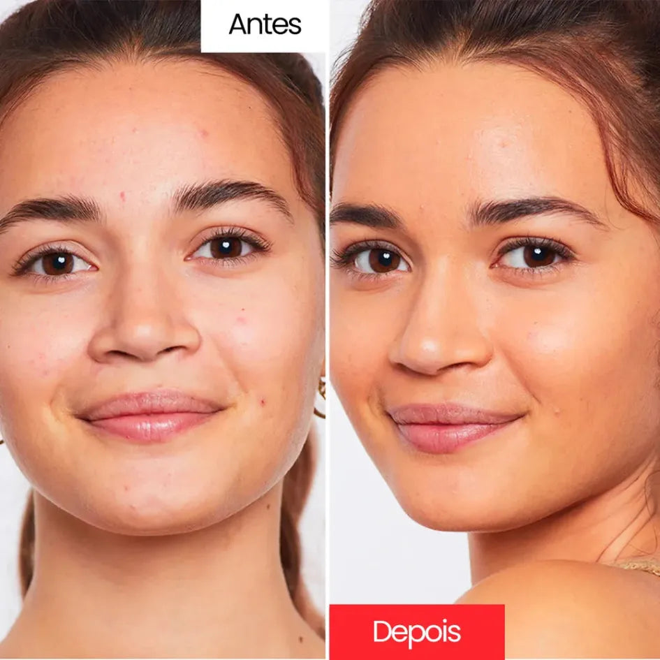 Centella Cream™ – Creme Corretivo Anti-Idade com Efeito Natural – Leve Mais e Pague Menos!