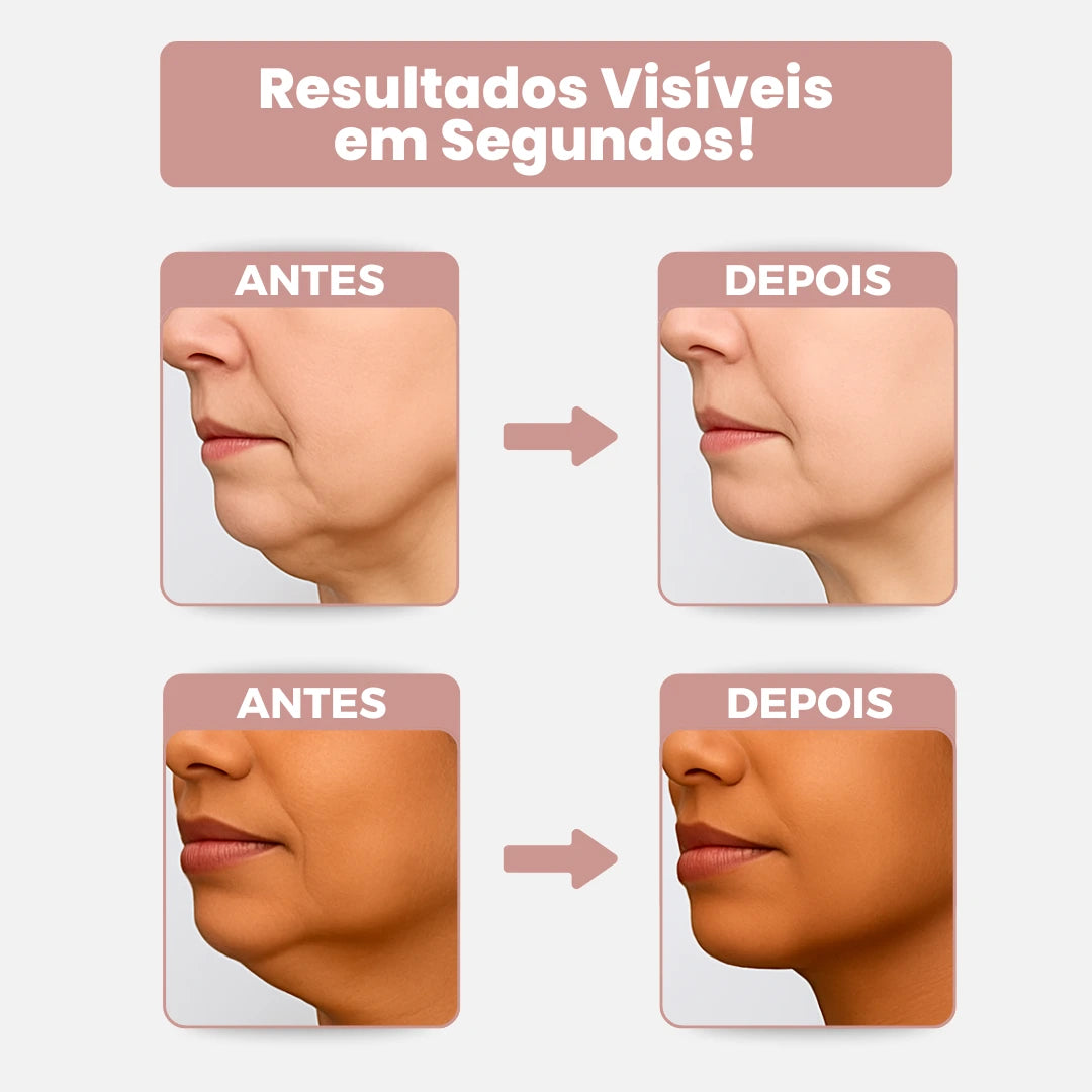 Belle Lift® - Adesivo Lifting (Antirrugas e Contra Flacidez no Pescoço) + BRINDE EXCLUSIVO!